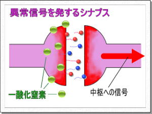 異常信号を発するシナプス