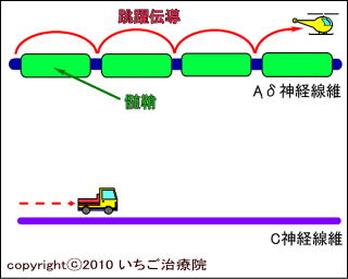 Ａδ神経とＣ神経の模式図