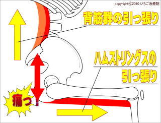 座位で新型腰痛が起きる原因