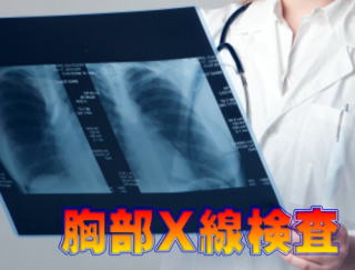 胸部X線写真を診察する医師