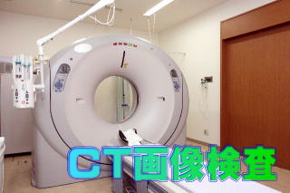 CT画像診断装置