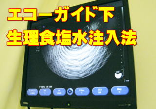超音波画像診断装置