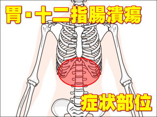 胃潰瘍・十二指腸潰瘍による症状部位・胸部
