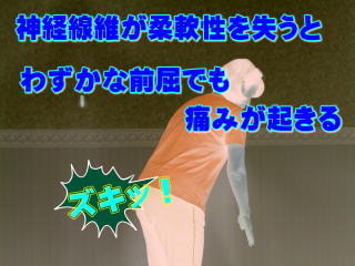 前屈で痛みが起きている人