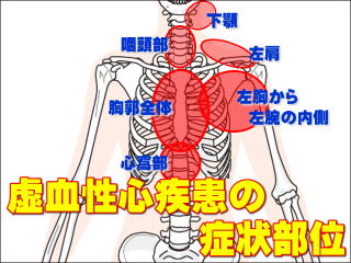 虚血性心疾患の症状発現部位 / 胸部