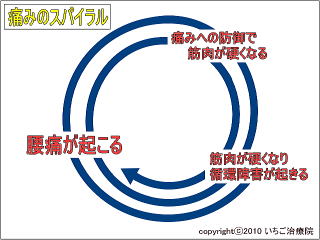 痛みのスパイラルの模式図