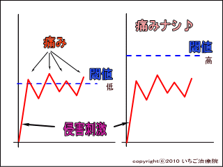 閾値の概念図