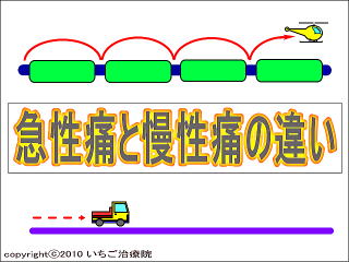 急性痛と慢性痛・イメージ画像