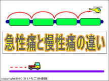 急性痛の様子