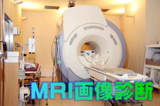 MRI画像診断装置