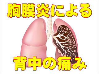 胸膜炎は腫瘍や結核、細菌感染などで発症しますが、原因はそれだけではなく、胸膜炎は幾つかのタイプに分けられます。