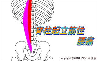 脊柱起立筋解剖図