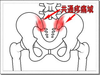 仙腸関節性腰痛疼痛域