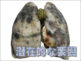 胸膜に転移した悪性腫瘍