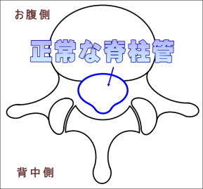 正常な脊柱管