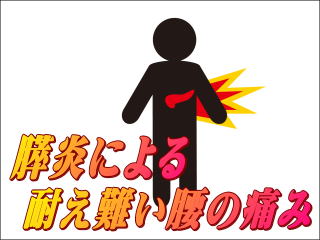 膵炎のイメージ画像