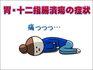 胃潰瘍・十二指腸潰瘍の症状の写真