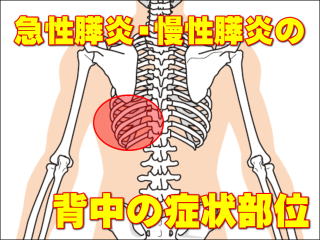 急性膵炎と慢性膵炎の背中の症状部位