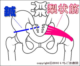 仙骨前面刺鍼の図解2