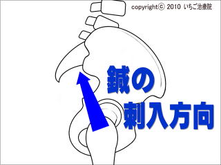 骨盤を側方から見た様子