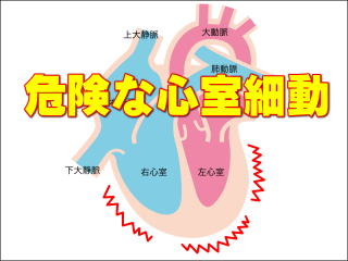 心室細動の様子